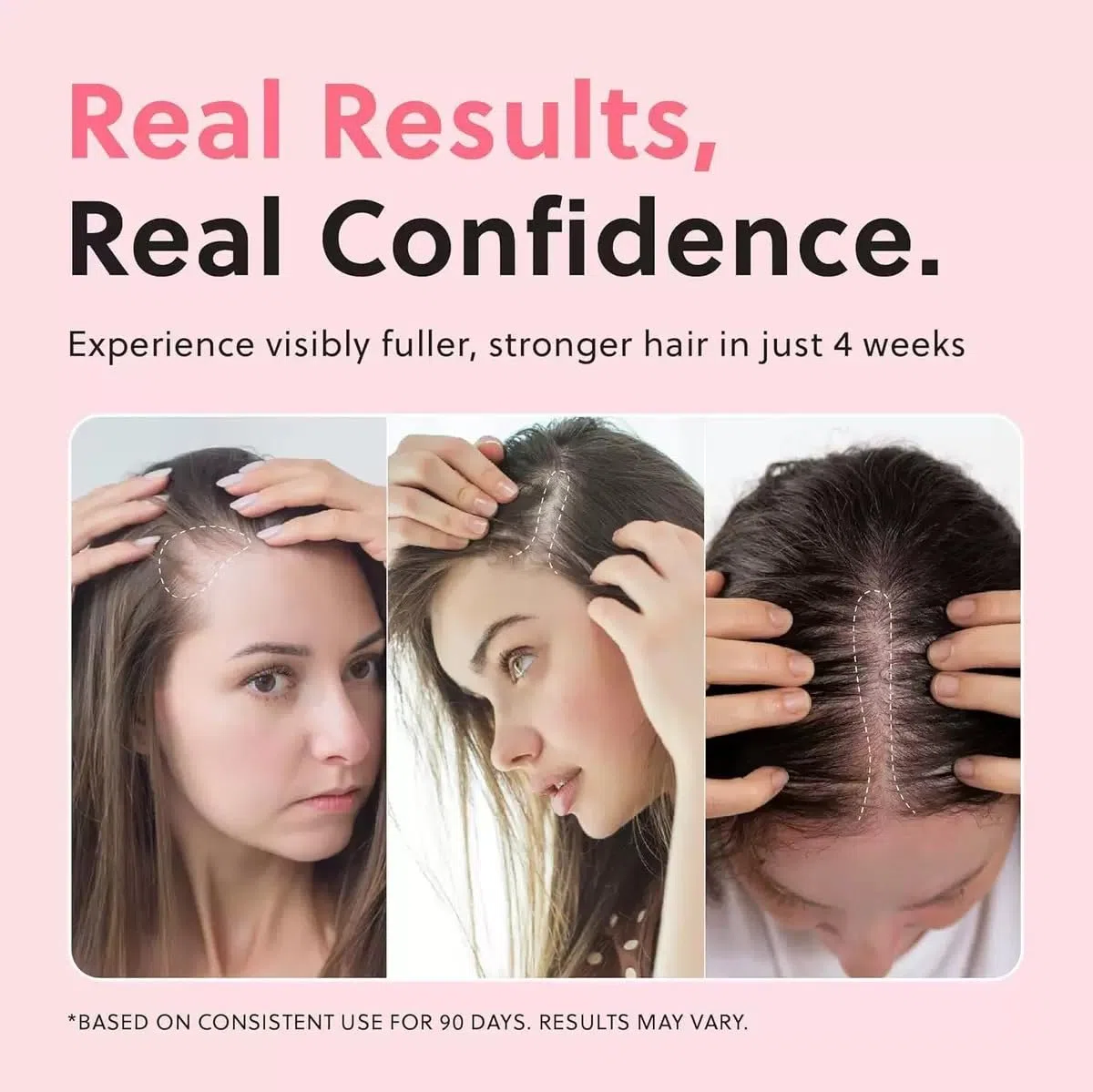 Aceite en spray para el crecimiento del cabello, esencia natural anticaída, refrescante y no graso, previene la caída del cabello, apto para cuero cabelludo seco.