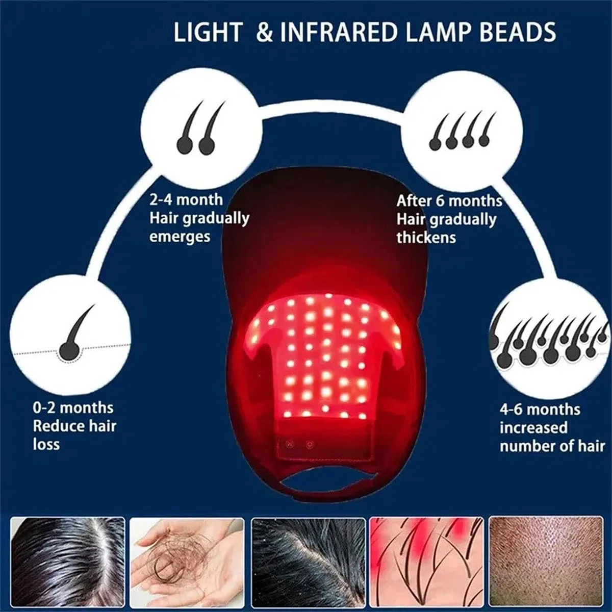 Gorro para El Crecimiento del Cabello (48 Led), Gorro para El Crecimiento del Cabello con Luz Roja Y Azul, 4 Modos, Control De Aceite, Promueve El Crecimiento RáPido del Cabello
