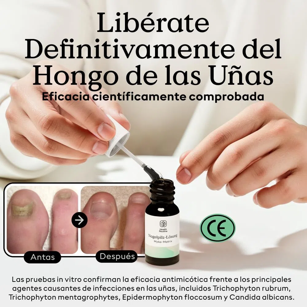 Health Routine Myko-Matrix solución antimicótica para uñas — Dispositivo médico CE para uñas dañadas — Tratamiento con aceite de árbol de té y aceites esenciales — desarrollado en Austria