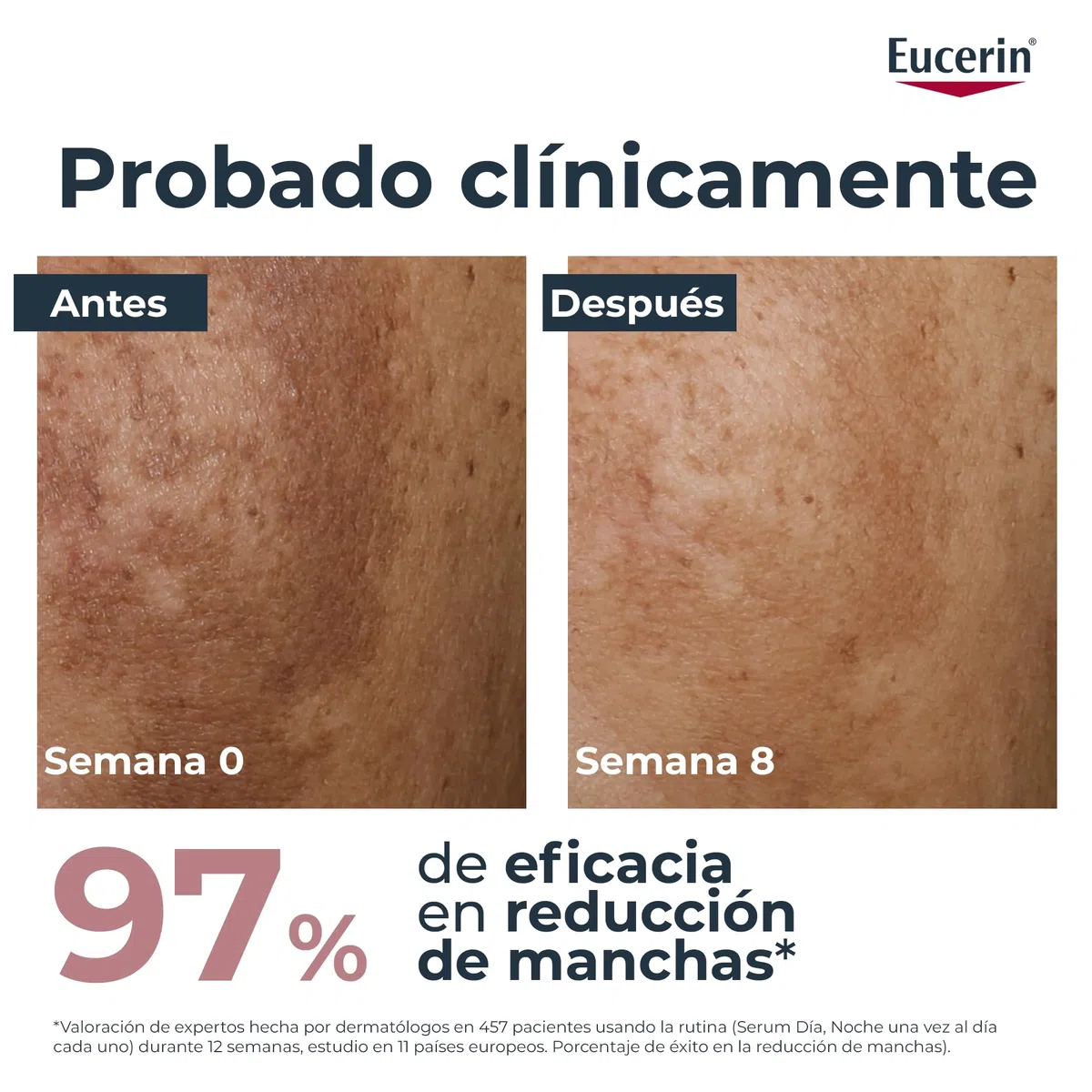 Eucerin Anti-Pigment Crema de Día con FPS 30 (50 ml), crema antimanchas para una piel más uniforme y radiante, con filtros UV y Thiamidol, hidratante facial para todo tipo de pieles