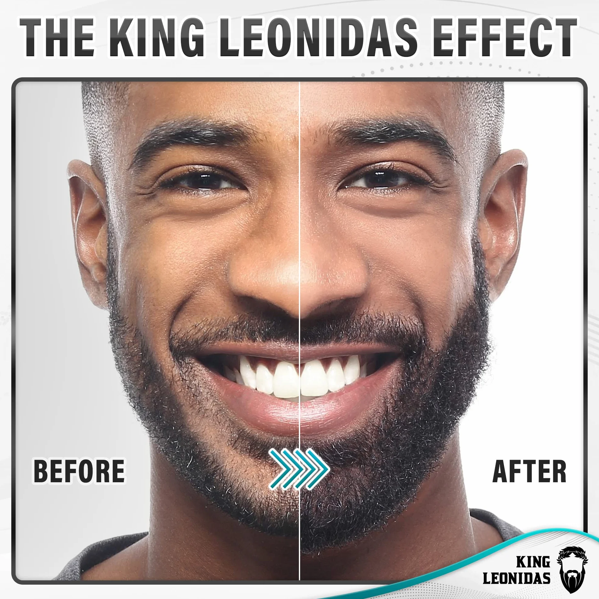 Kit de crecimiento de barba King Leonidas con rodillo Derma de 0,25 mm, herramienta de microagujas para hombres, cuidado profesional del vello facial con bálsamo para barba y aceite para barba