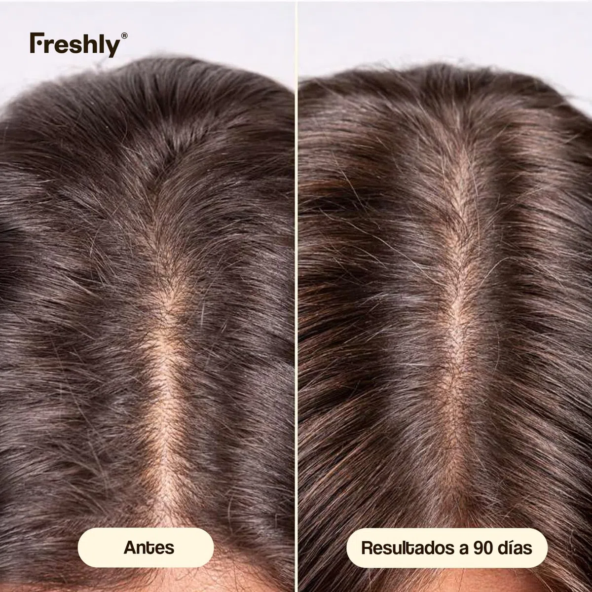Freshly - Tratamiento Serum Capilar Anticaída del Pelo Hair Growth & Density Treatment - Fórmula 99,9% Natural - Para el Crecimiento y Densidad del Cabello - Pelo Fuerte y Saludable - 50 ml