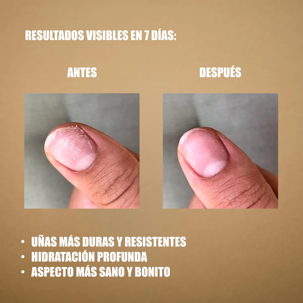 Gel reparador y fortalecedor de uñas y cutículas | Resultados en 7 días | Hidrata, endurece y da brillo | Eficaz con o sin esmalte | 3 ml