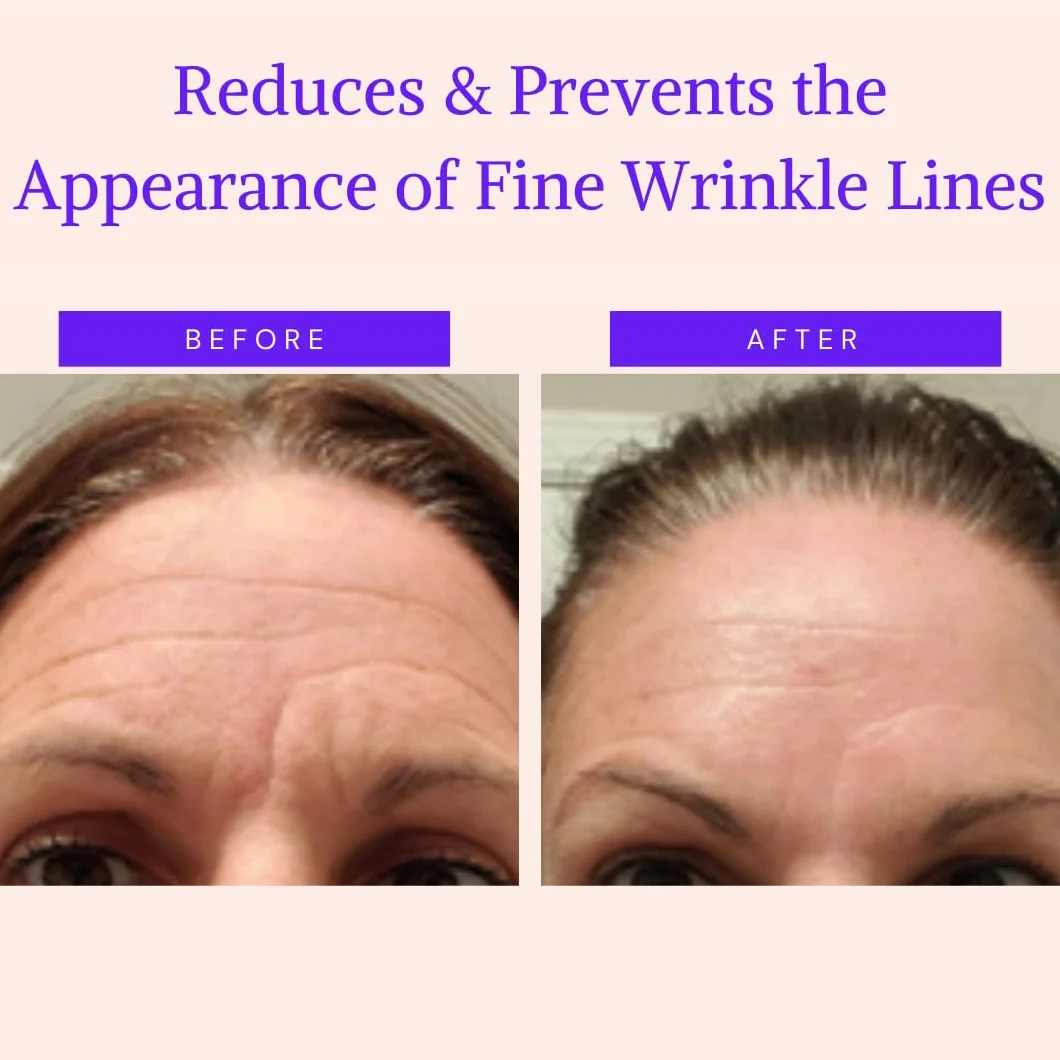 Parches para las Arrugas de Cara - Almohadillas para Suavizar e Hidratar la Piel de Ojos, Boca y Frente - Antiarruga Faciales Durante la Noche - Antienvejecimiento, Alternativa al Botox (165 uds)