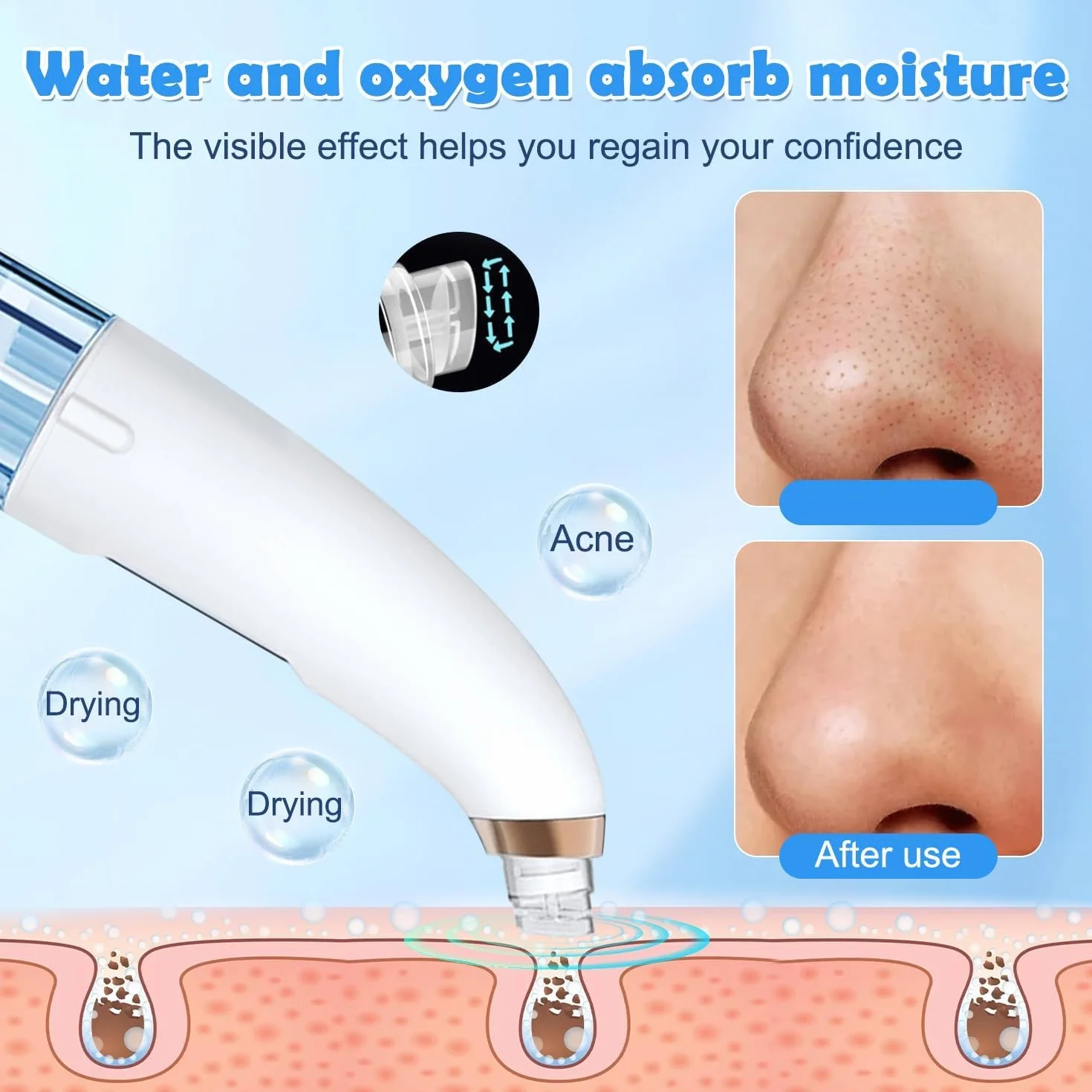 Succionador de Puntos Negros, Limpiador de Poros Facial Eléctrico Con 6 Cabezales y 3 Modos, Extractor de Puntos Negros Facial para Eliminars Puntos Negros, Comedones y El Acné Graso