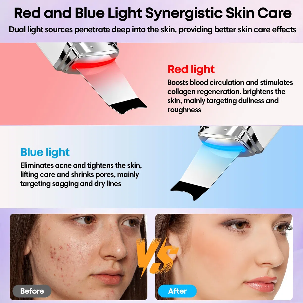 Peeling Ultrasónico Facial, Limpiador Ultrasonidos Facial, 4 Modos e Intensidad Ajustable, Extractores de puntos negros, Skin Scrubber Removedor de Puntos Negros para Dispositivo de Belleza