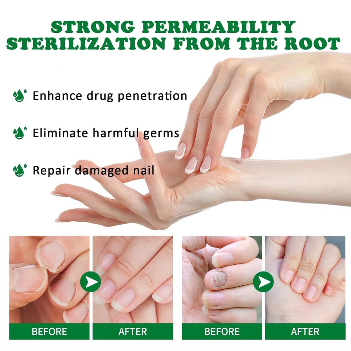 Tratamiento de hongos de uñas de 7 días, soporte de uñas de jengibre CUIDADO, 1 FL.OZ Multi-usose uñas de reparación de suero, para uñas finas, frágiles, peladas y agrietadas (2pcs)