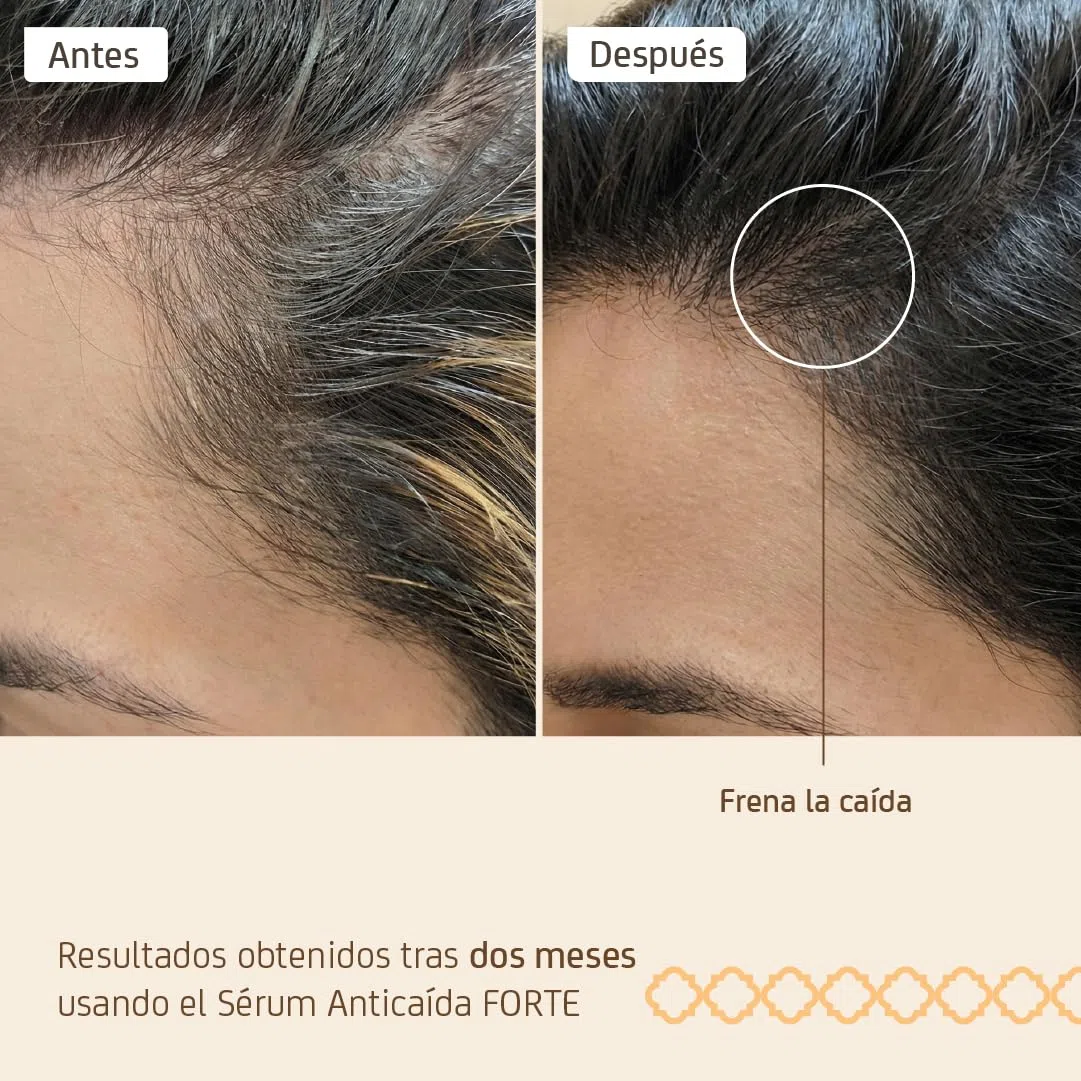 Nuggela & Sulé Sérum Anti-Caída Forte 70 ml Tratamiento Capilar