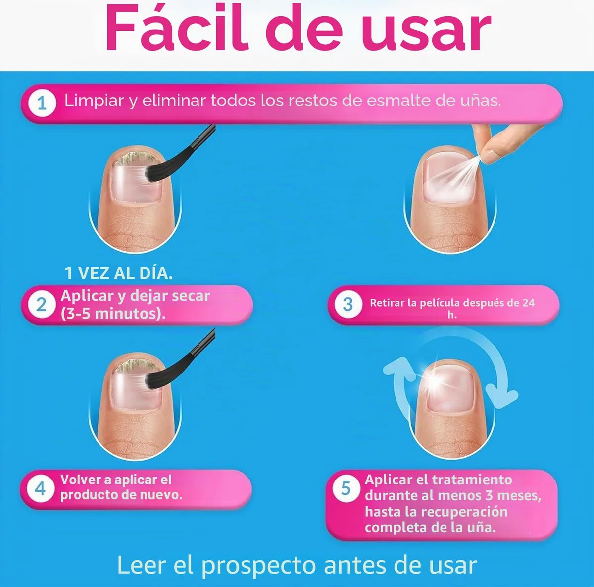 Excilor - Forte - Tratamiento de la micosis de las uñas - Contra la micosis de las uñas persistente - Fácil aplicación con pincel - Sin limar - Clínicamente probado - 30 ml