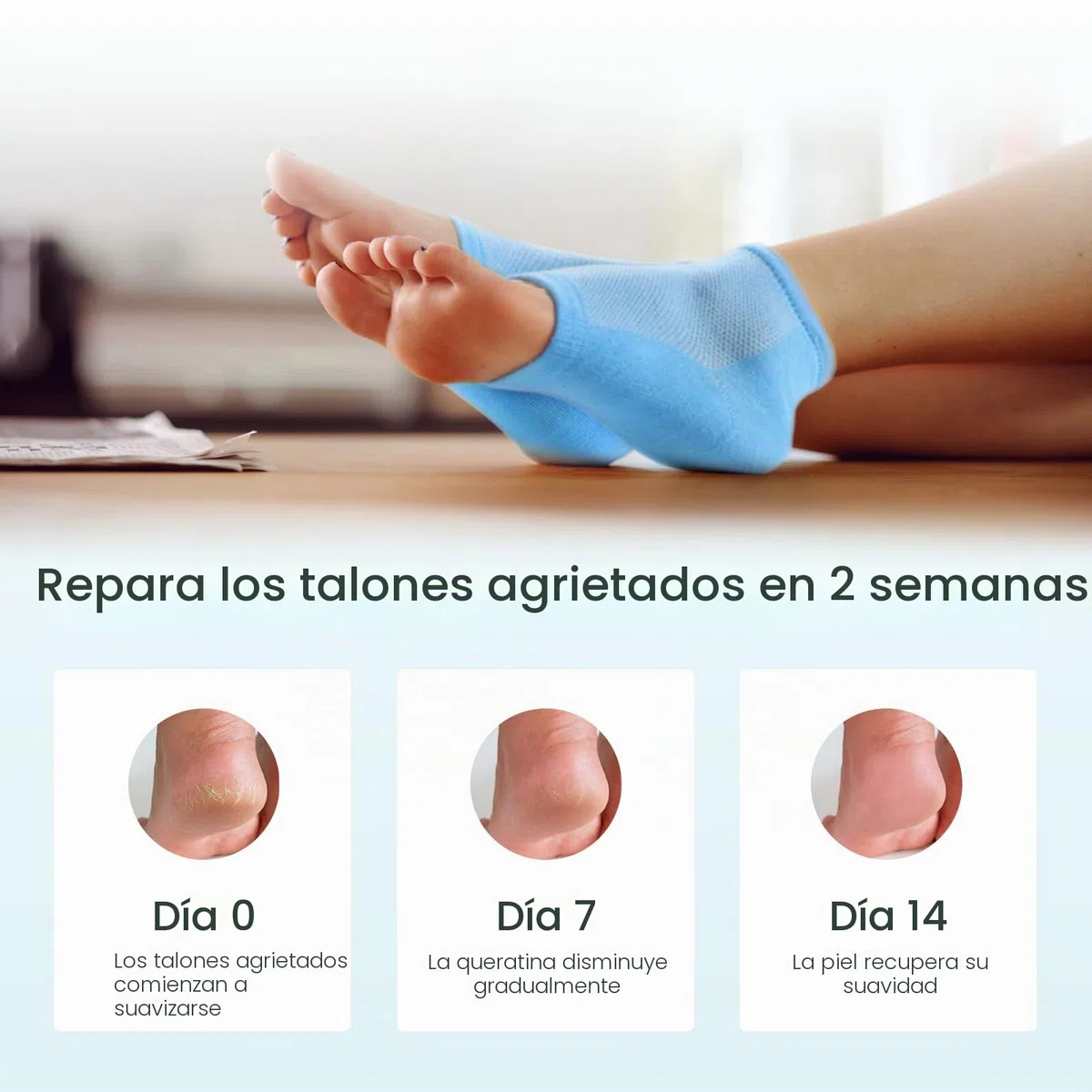 Calcetines hidratantes para el tratamiento de talones agrietados - Promifun 2 pares de calcetines hidratantes para pies secos y agrietados - Reparación de talones agrietados - Calcetines para mujeres
