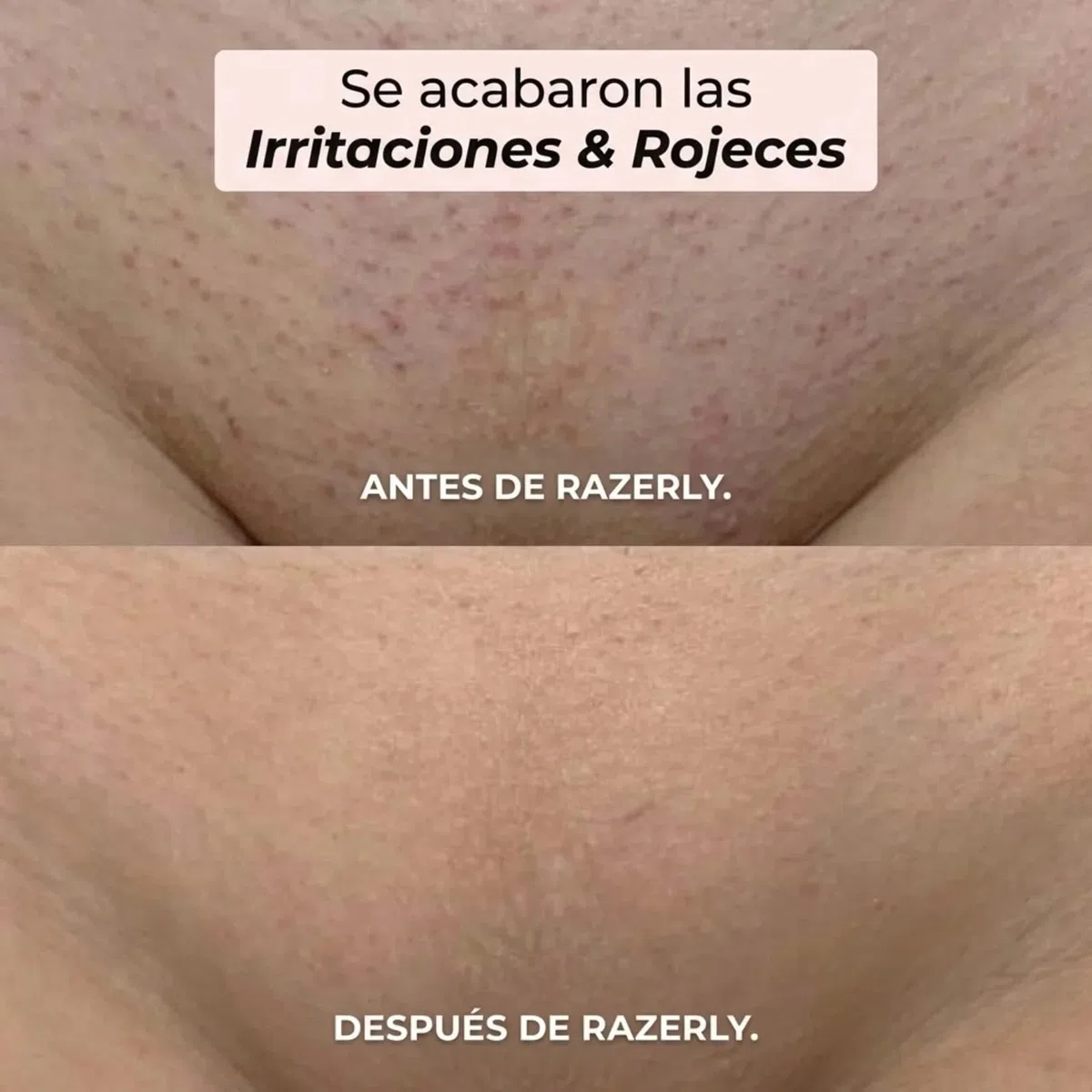 Razerly Maquinilla Mujer, Maquinilla 2 En 1para Bikini Ycuerpo Razerly, Razerly Depiladora, Maquinilla Electrica Femenina Para Zona Intima Axilas Piernas Y Piel Sensible (Azul)