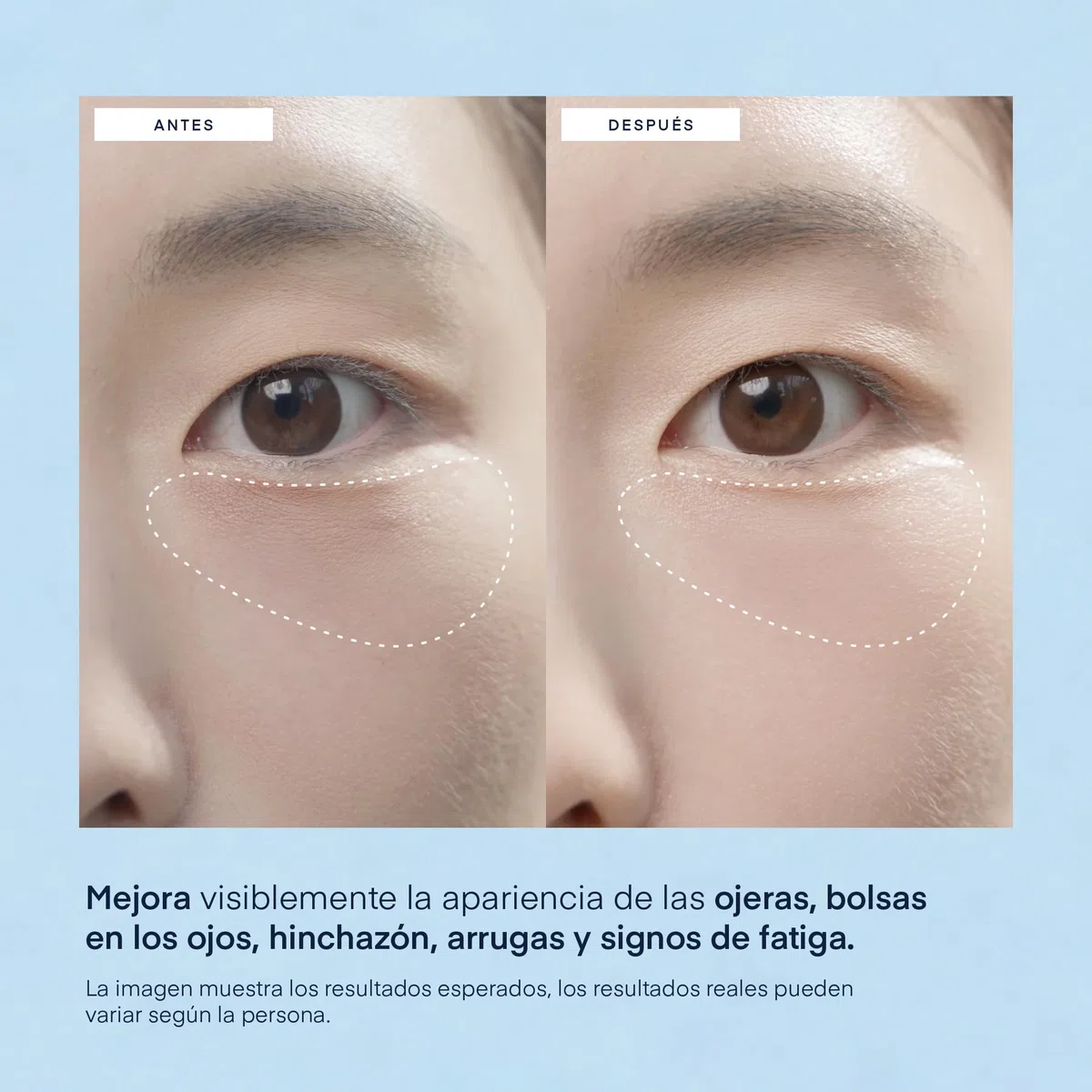 Parche Ojos para Bolsas y Ojeras Coreano: Antiarrugas y Contorno de Ojos con Cafeína Niacinamida y Ácido Hialurónico, Vegano, Testado en Piel Sensible, 30 Pares - Korean Skincare Under Eye Patches
