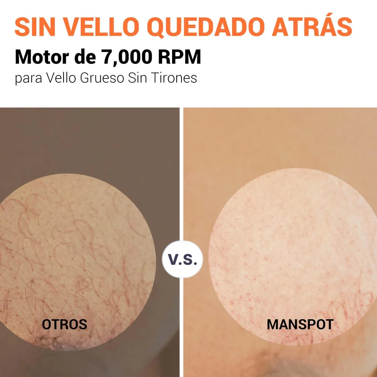 MANSPOT Afeitadora Corporal Masculina, Depiladora Corporal Hombre con Cuchilla de Cerámica Desmontable, IPX7 Resistente al Agua, Seco y Húmedo, para Axilas, Pecho, Piernas y Genitales