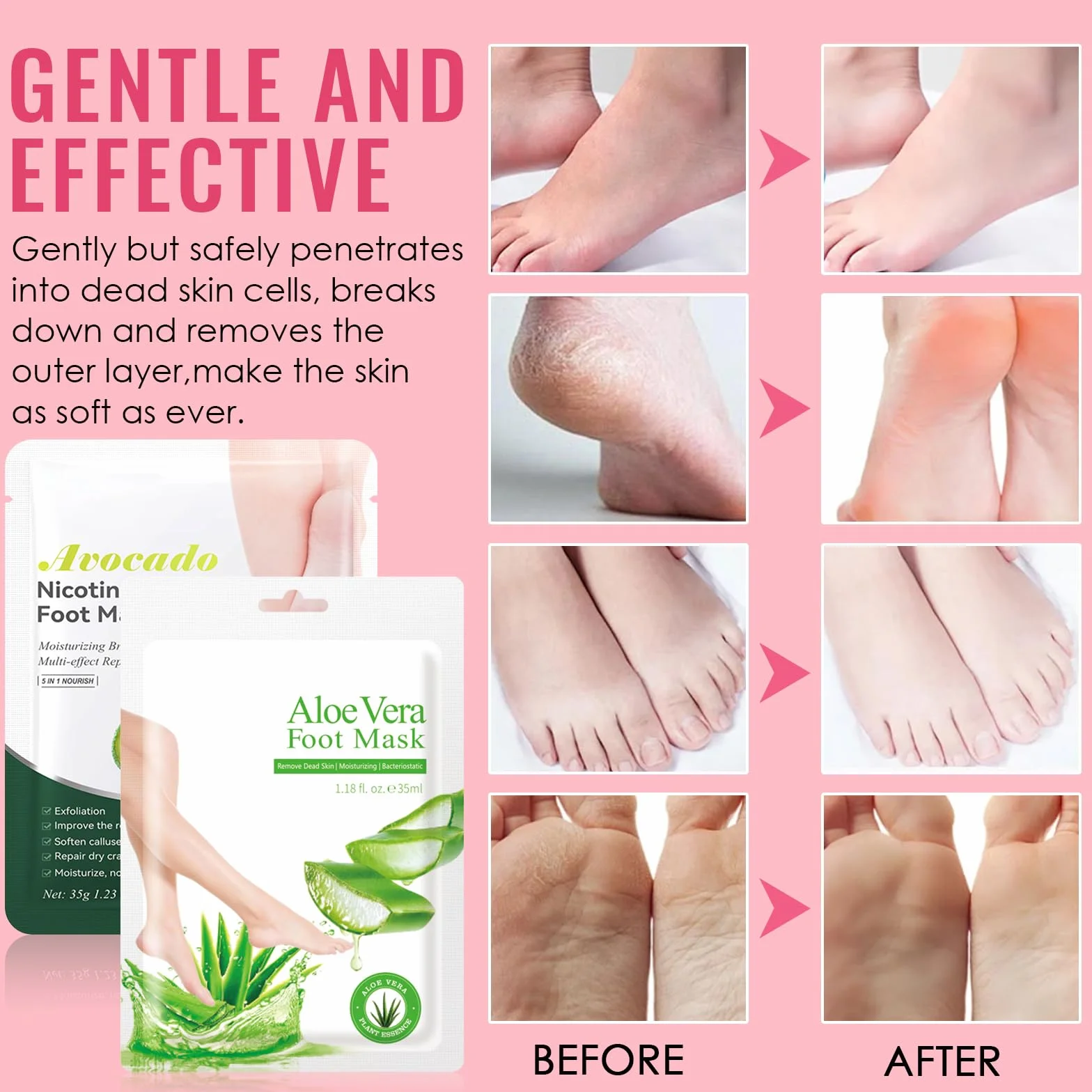 2 Pares Mascarilla Pies Exfoliante, Peeling Pies, Repara los Talones, Exfoliante Pies para Mujeres y Hombres, Quitar Piel Muerta y Callos, Hidrata y Nutre Tus Pies (Aloe Vera + Aguacate）