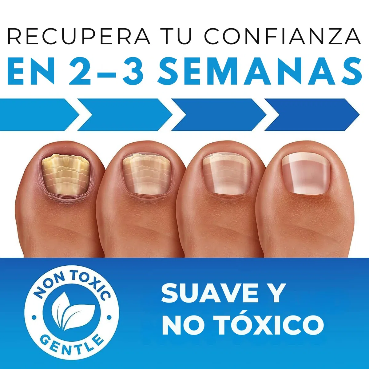 Imperial Feet Nail Mycosis Quita Hongos Uñas Pies-Tratamiento Hongos Uñas Pies-Fortalecedor de Uñas-Ablandador de Callos y Durezas-Tratamiento Hongos Uñas-Reparador Uñas Dañadas y Debiles-XL 75ML