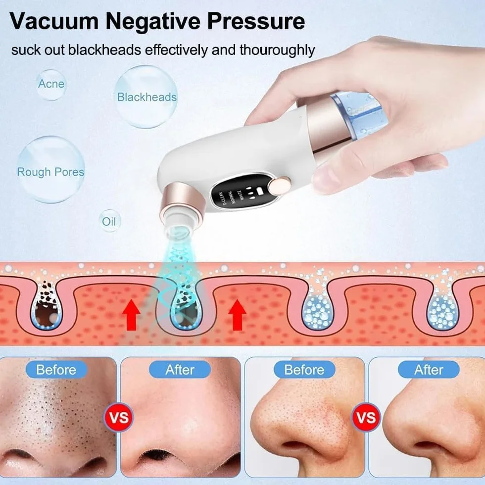 Succionador de Puntos Negros, Limpiador de Poros Facial Eléctrico Con 6 Cabezales 3 Modos, Extractor de Puntos Negros Facial para Eliminars Puntos Negro, Comedones y El Acné Graso