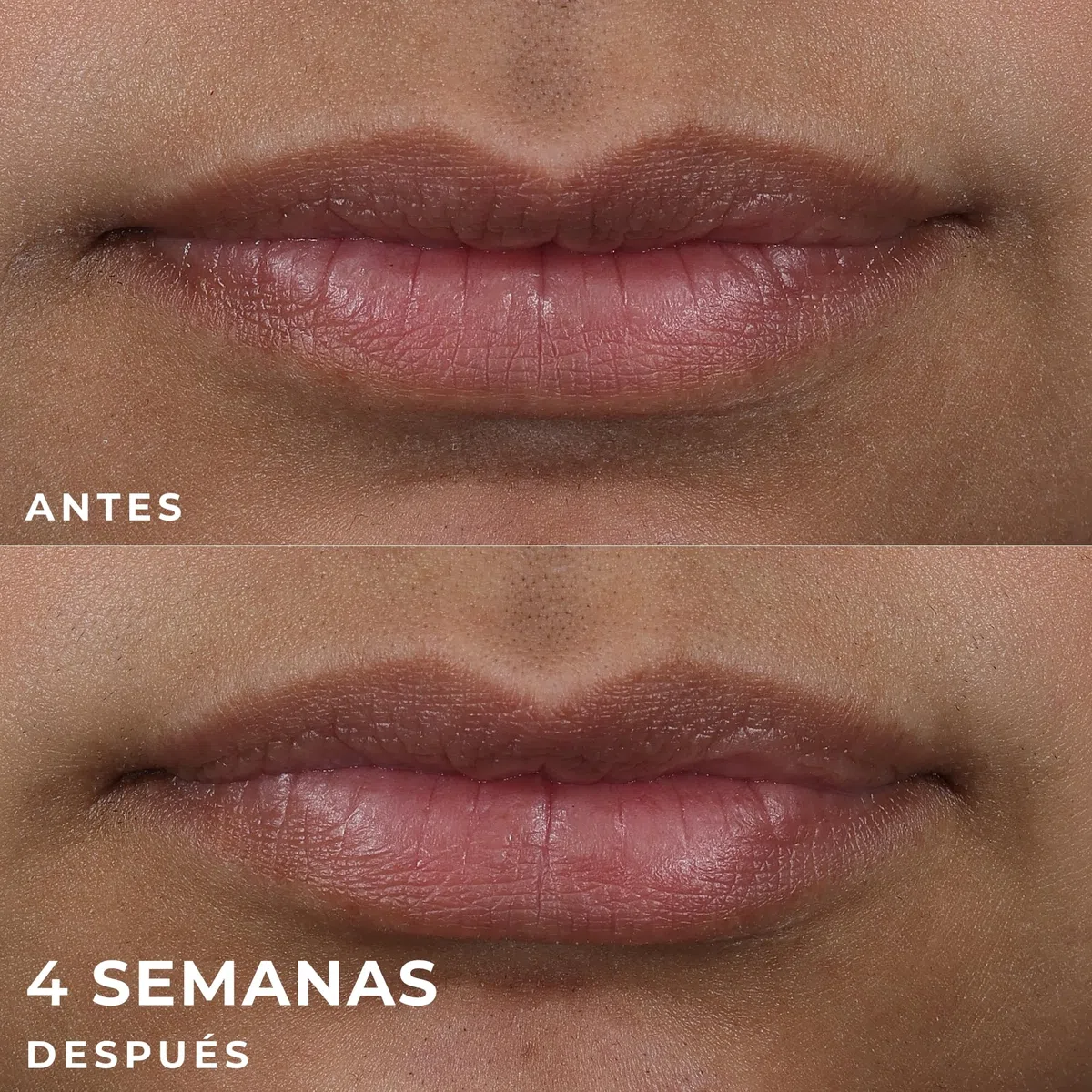 RoC Derm Correxion Lip Volumizer | Bálsamo Rellenador para Labios con Ácido Hialurónico y Péptidos de Colágeno | 10 ml