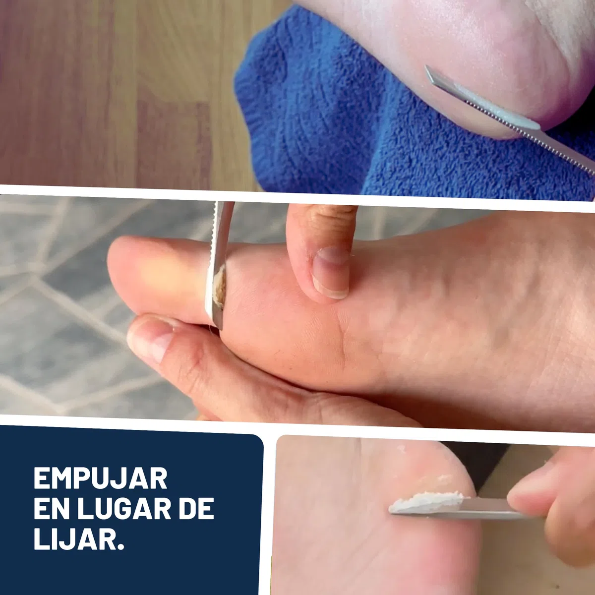 Mr. Fuss Removedor de Callos Solution No. 4 Advanced Pack Steel Quitar las Durezas Sin Raspar ni Frotar Paquete de Sistema de 4 Partes para la Eliminación de Callosidad y Cutícula