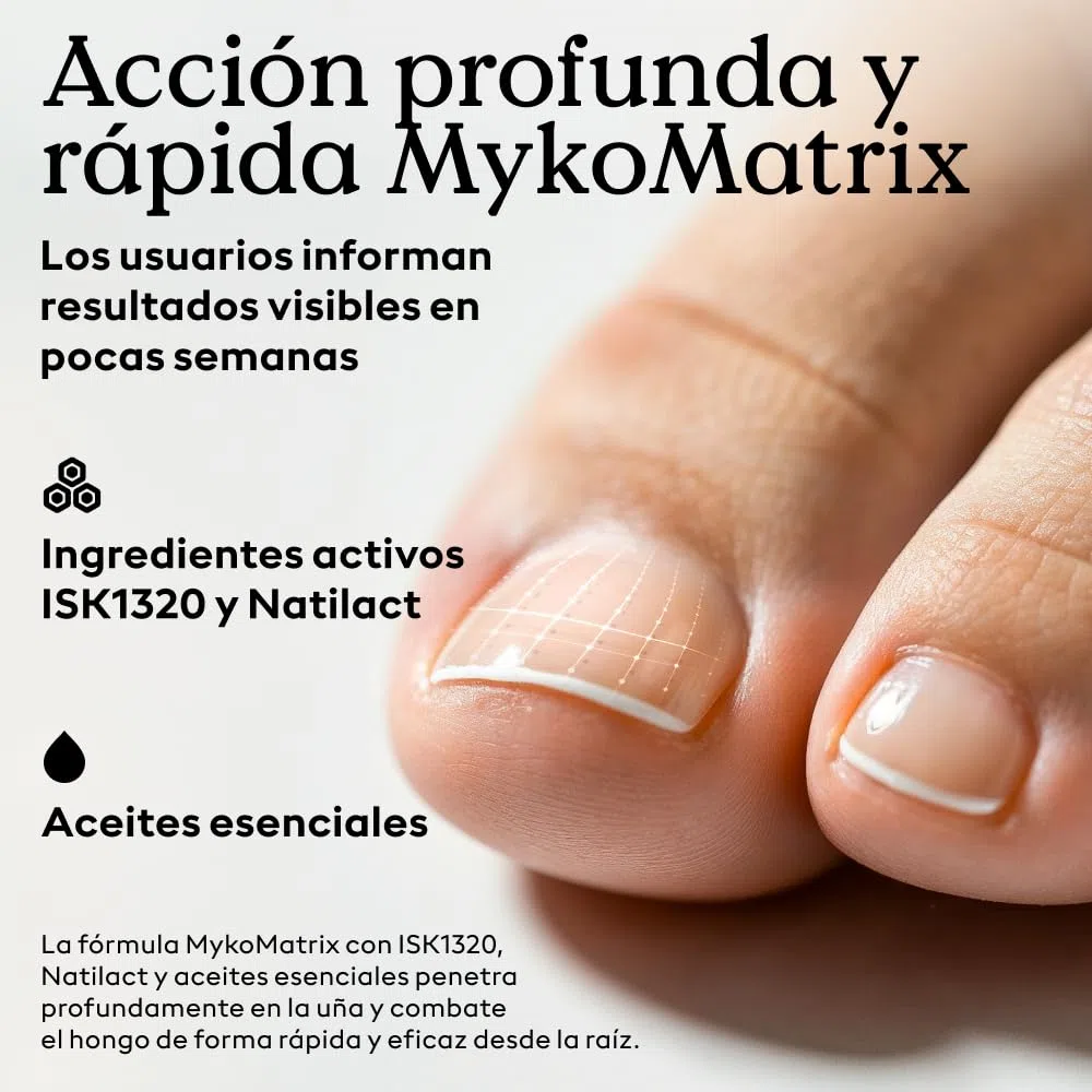 Health Routine Myko-Matrix solución antimicótica para uñas — Dispositivo médico CE para uñas dañadas — Tratamiento con aceite de árbol de té y aceites esenciales — desarrollado en Austria