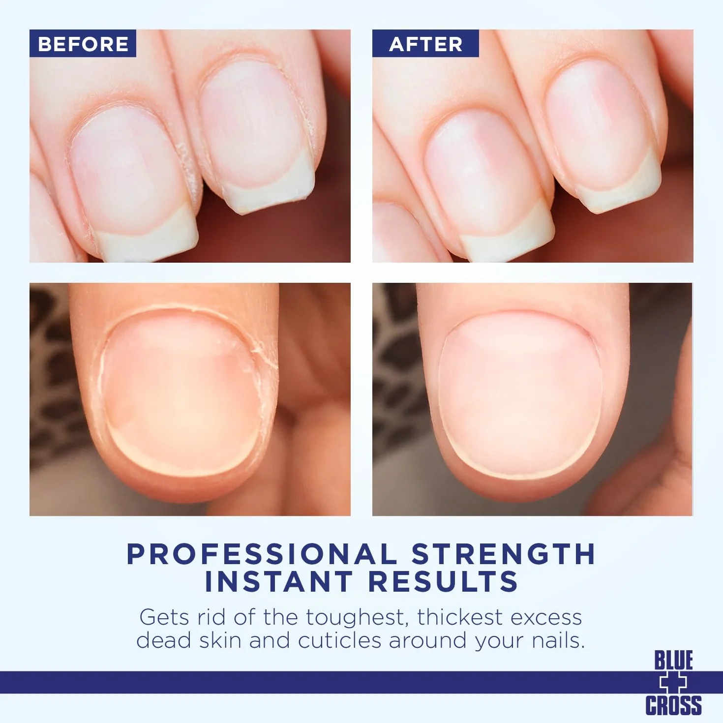 Blue Cross Cuticle Remover 6 Oz by BLUE CROSS BEAUTY PRODUCT