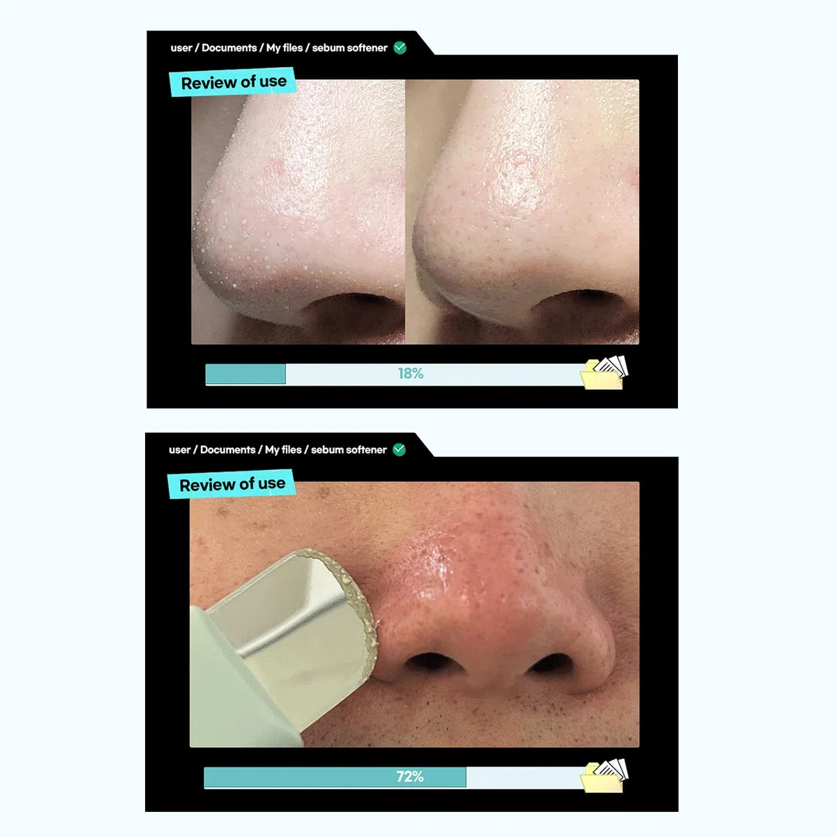 ILSO Super Melting Sebum Softener, 156,4 ml, con 40 almohadillas de algodón incluidas