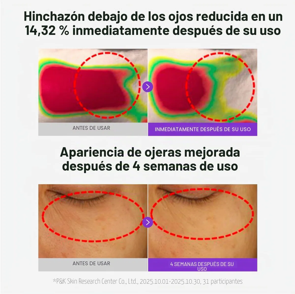 CENTELLIAN 24 360 Shot PDRN - Parche brillante para los ojos (6 juegos, 12 unidades) – Parches de hidrogel revitalizante instantáneo y revitalizante de círculos oscuros debajo de los ojos con PDRN