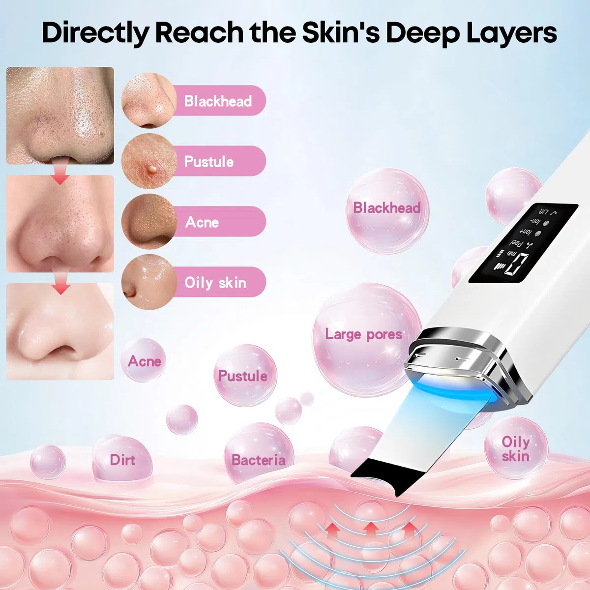 Peeling Ultrasónico Facial, Limpiador Ultrasonidos Facial, 4 Modos e Intensidad Ajustable, Extractores de puntos negros, Skin Scrubber Removedor de Puntos Negros para Dispositivo de Belleza