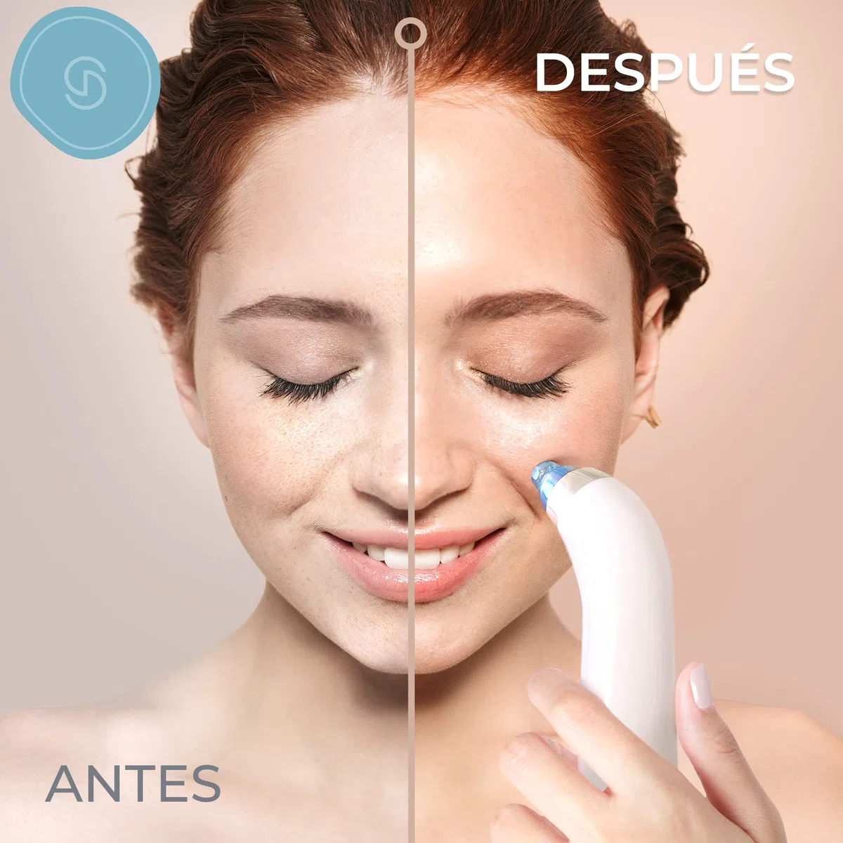 Essy Limpiador de Poros Succionador de Puntos Negros y Espinillas Extractor Puntos Negros Removedor Aparato para Quitar Acne Microdermoabrasion Limpia Poros Blackhead Remover Vacuum Pore Cleanser